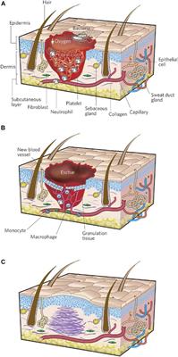 Hydrogel Scaffolds to Deliver Cell Therapies for Wound Healing